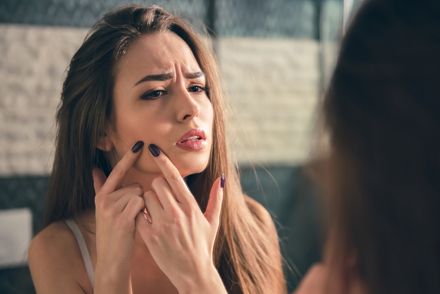 高校生のニキビケアおすすめ 10代男女に人気のスキンケアグッズ トラブルブック
