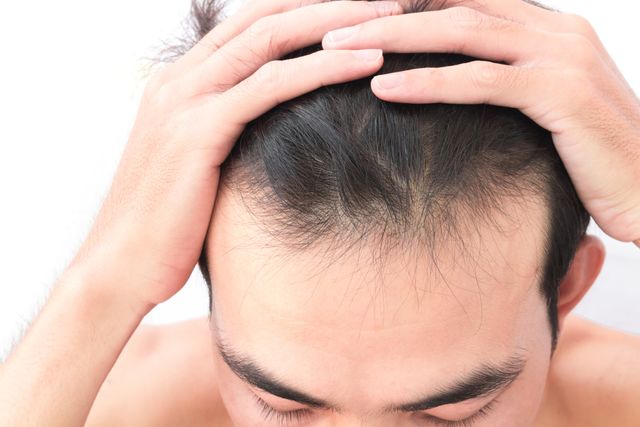 【広島】AGA治療のおすすめクリニック10選!人気のクリニックを紹介