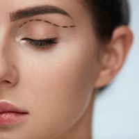 札幌 二重整形におすすめのクリニック12選 埋没法と切開法の違いも紹介 自分らしい便利な暮らしを トラベルブック Travelbook