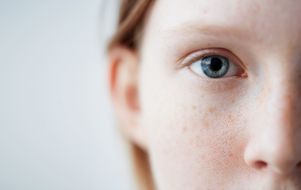 シミ取りレーザー治療 美容整形 新宿 おすすめクリニック 美容外科18選 自分らしい便利な暮らしを トラベルブック Travelbook