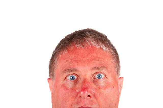 赤ら顔におすすめ!メンズ化粧水15選*人気商品を比較