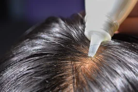 おすすめ市販発毛剤 人気19選 自分らしい便利な暮らしを トラベルブック Travelbook