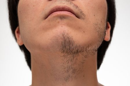 ヒゲ脱毛 五反田 人気おすすめの脱毛サロン クリニック8選 トラブルブック