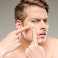 男性の顎ニキビの原因とは 対策と正しいスキンケアを紹介 自分らしい便利な暮らしを トラベルブック Travelbook 男性の顎ニキビの原因とは 対策と正しいスキンケアを紹介 自分らしい便利な暮らしを トラベルブック Travelbook