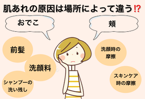 肌を綺麗にする方法とは 基本の3ステップや身につけたい生活習慣を紹介 トラブルブック 肌を綺麗にする方法とは 基本の3ステップや身につけたい生活習慣を紹介 トラブルブック
